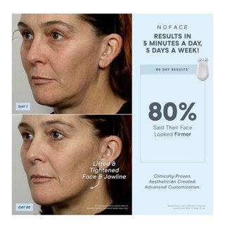 NuFACE Trinity Starter Kit微電流 電波拉皮緊緻 提拉抗皺美容儀-4