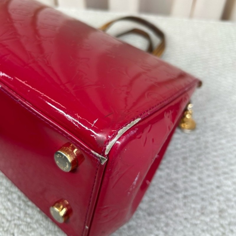 LV路易威登漆皮醫生包 老花壓紋 漆皮復古氣場全開 包型優雅又有力量感 容量實用能裝 缺肩帶 可手提 日常百搭-10