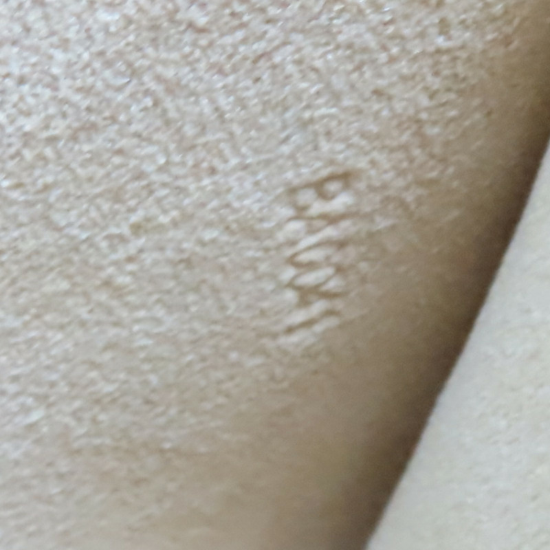 米色 牛皮 塗鴉 Alma Horizontal 手提包【LOUIS VUITTON LV 路易威登】 M92176-6